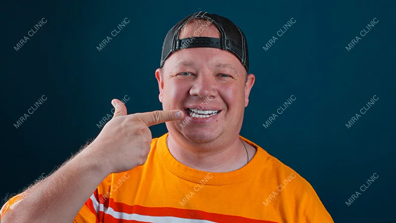 Chef Mike Smile Makeover